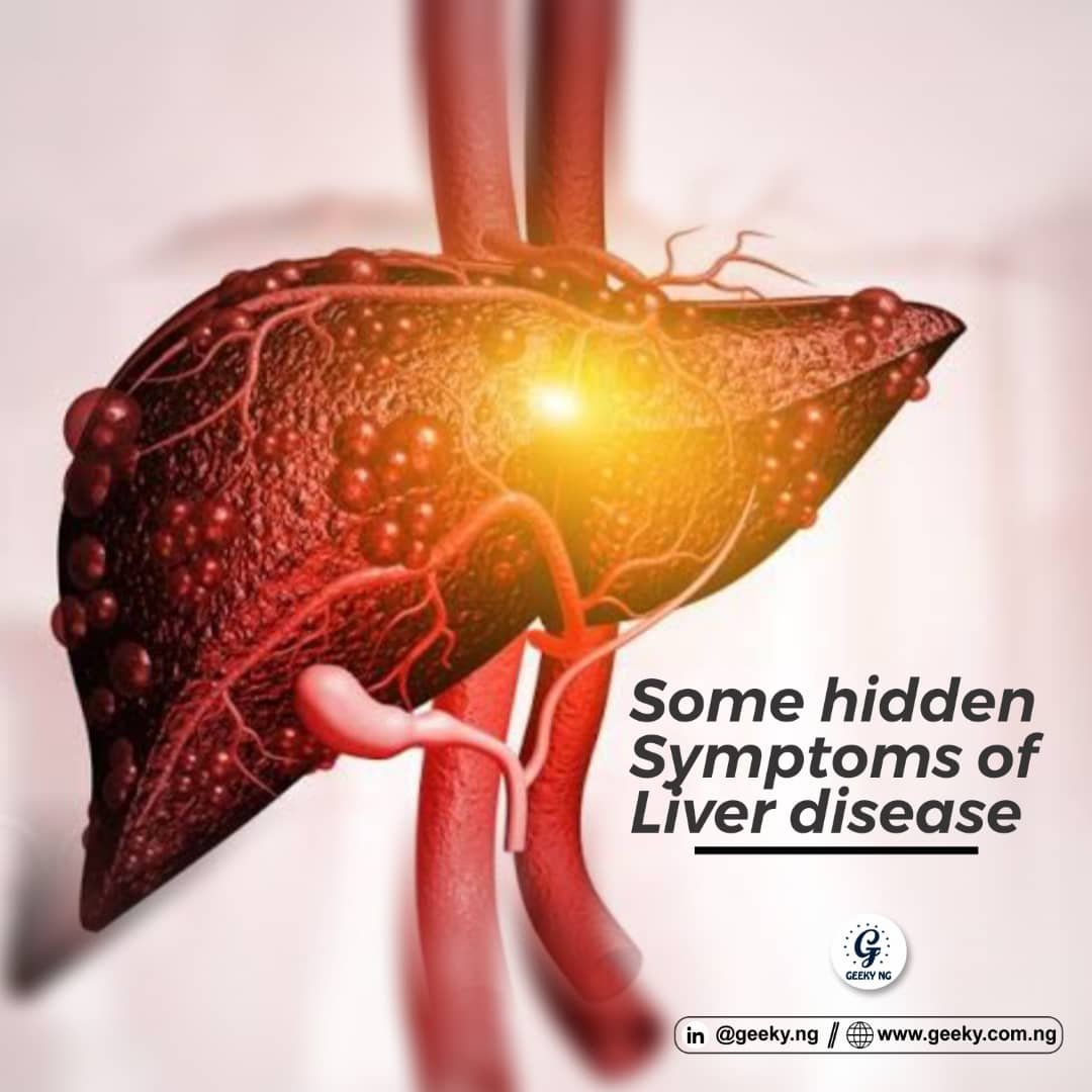 6 Hidden Symptoms Of Liver Disease - Geeky Nigeria